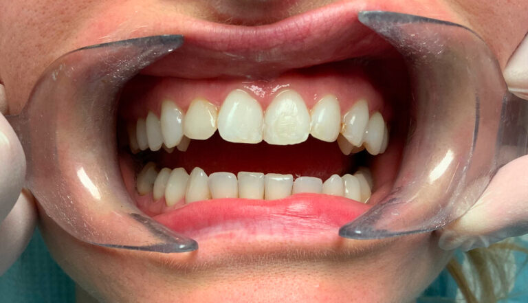 Metamorfoza 8 - przed