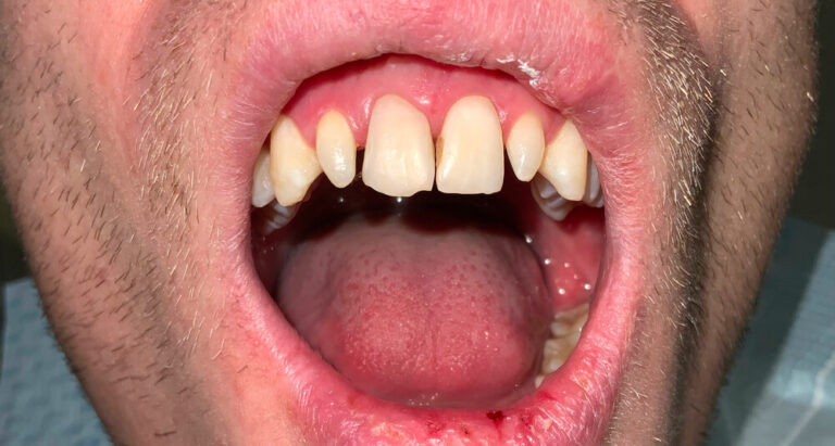 Metamorfoza 9 - przed