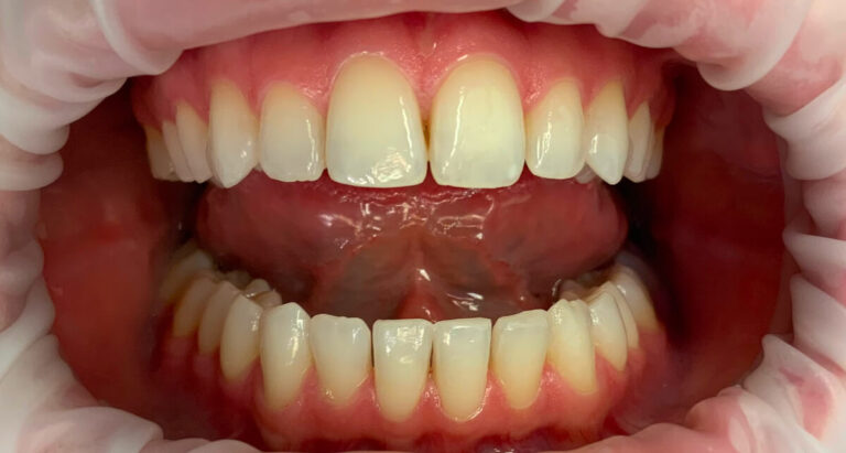 Metamorfoza 6 - przed