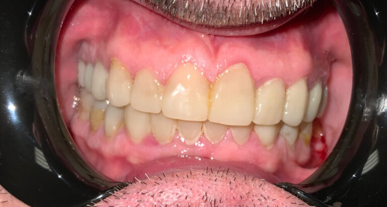 Metamorfoza 12 - przed