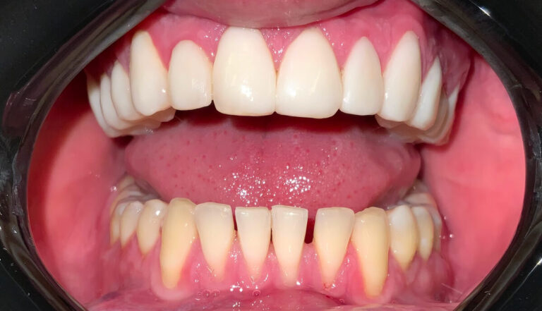 Metamorfoza 7 - przed